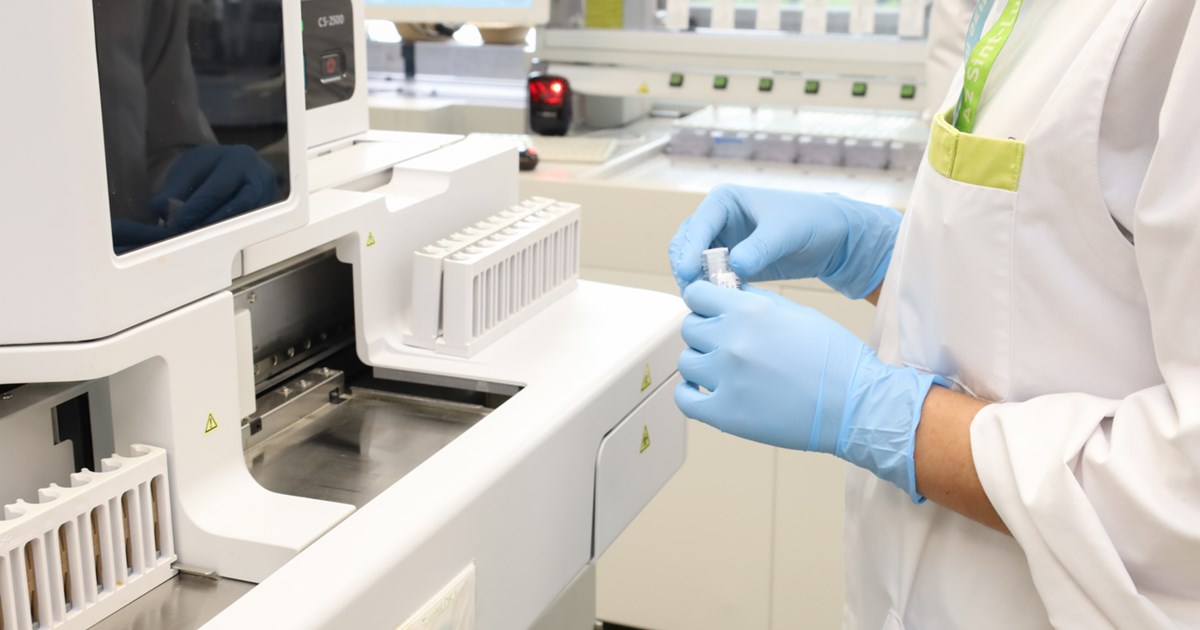 Urgente DOAC-bepaling in het laboratorium Klinische Biologie - AZ Sint ...