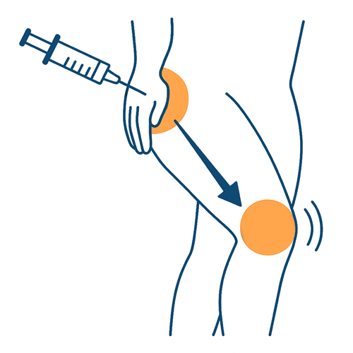 illustratie knie heup
